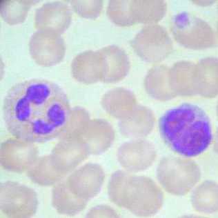 neutrophil & lymphocyte
