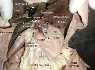 liver, stomach and duodenum, labeled