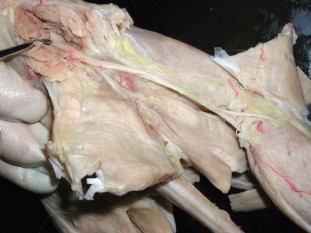sciatic nerve branches to form the tibial and peroneal nerves