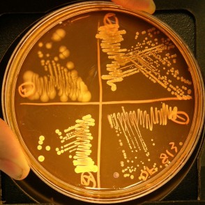 Single colonies after incubation