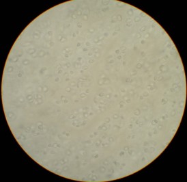 Cells in cartilage, a la Schwann, unstained