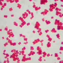 cocci, in cubes of eight called "sarcinae"