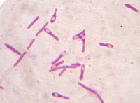 Clostridium_botulinum_P2253091sm