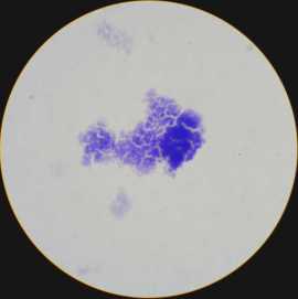 Staphylococcus_aureus_1000_P7090108