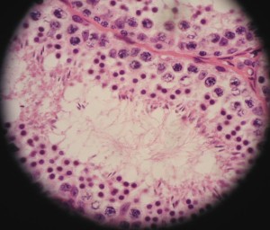 secondary spermatocytes
